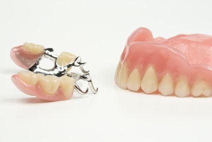 Herausnehmbarer Zahnersatz hier Teilprothese und Vollprothese
