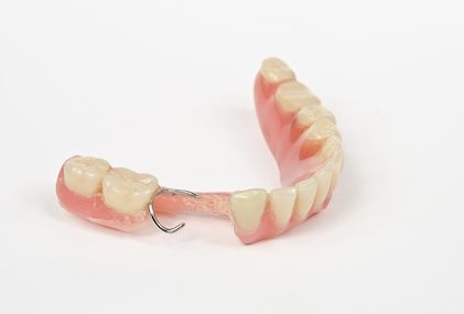 Interimsprothese