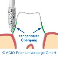Tangentialpräparation